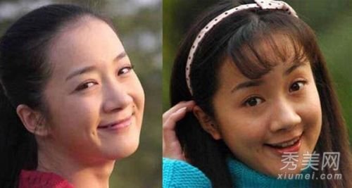 李依曉承認整容 私照曝光揭5次整容細節(jié)(圖)