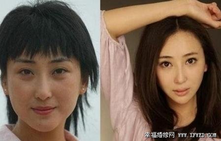 為她而戰(zhàn)嚴(yán)屹寬老婆杜若溪個人資料 揭秘杜若溪整容上位史