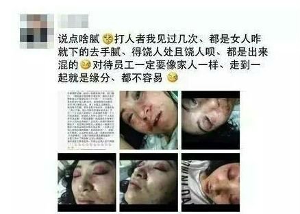 女歌手拒陪酒被暴打  女歌手遭暴打與私照對比（4）