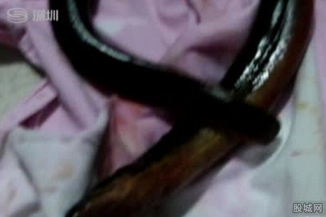 男子被黃鱔鉆肛門