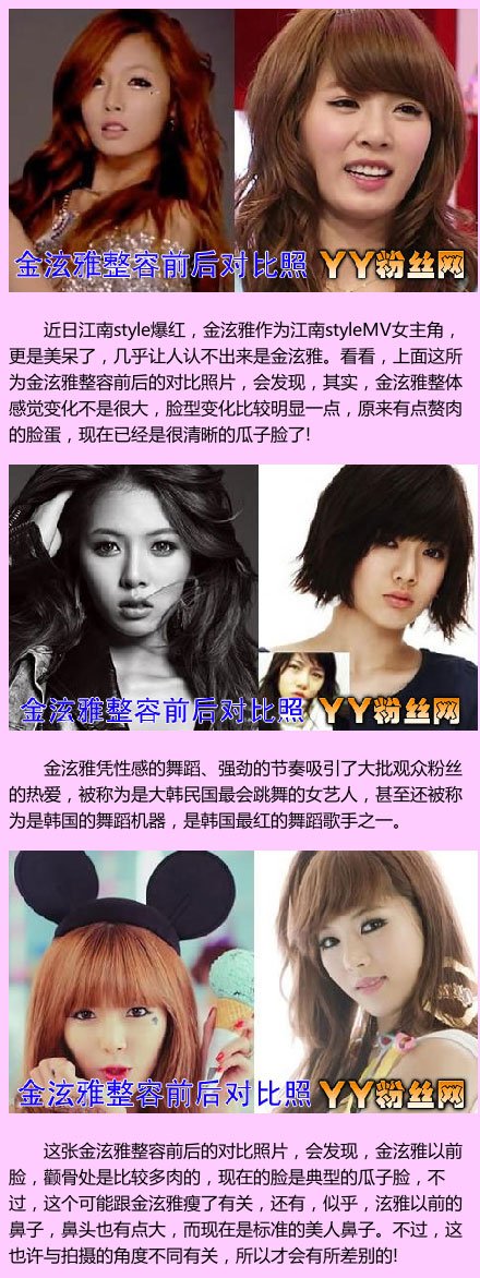 金泫雅整容前后照片對比