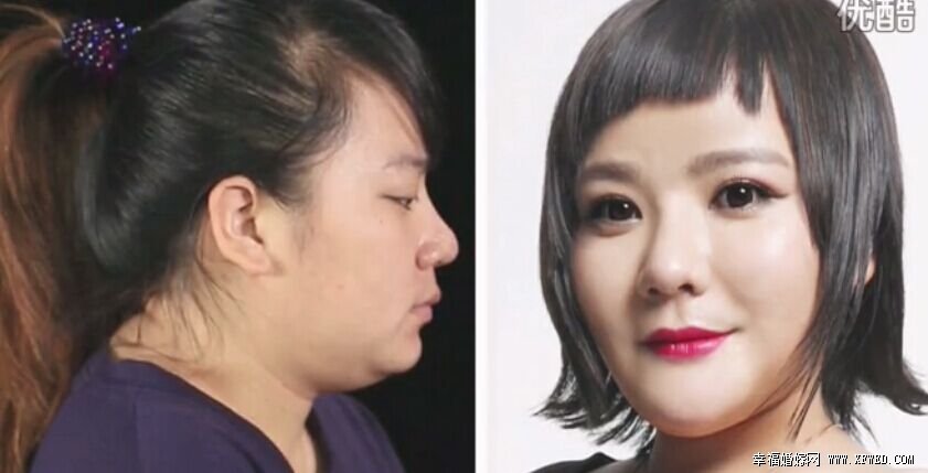 U美人唐小婷個(gè)人資料及整容前后對(duì)比 唐小婷為減肥吃蛔蟲卵失敗