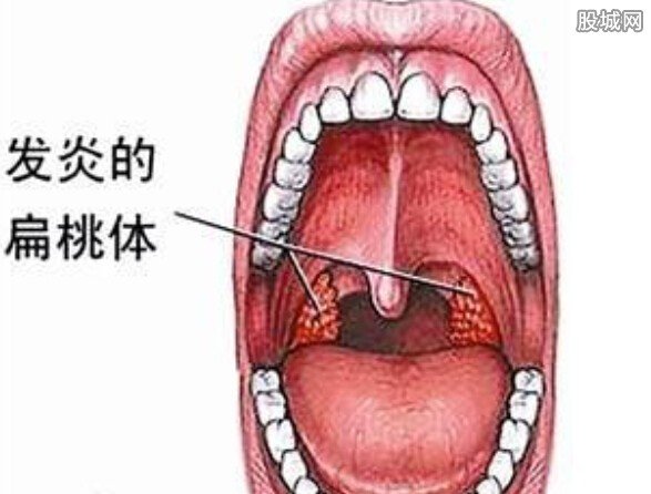 女子喉嚨不適信偏方